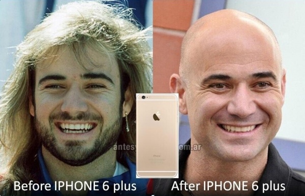 iPhone6头发门