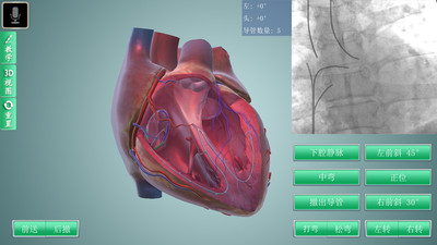 3D Heartv1.63 °