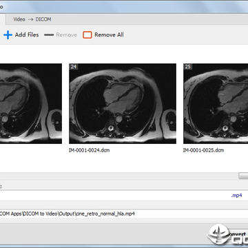 DICOM to Video