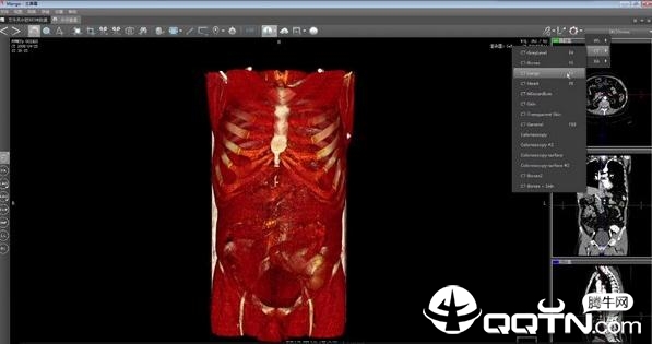医三维v1.0 官方版