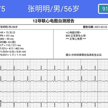 健康2030智能读图心电图系统 健康2030智能读图心电图系统