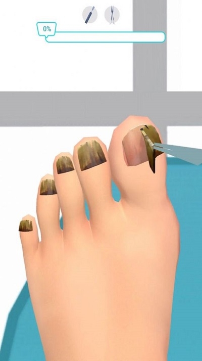 �㲿����ģ��v1.1.1 ���°�
