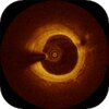 Cornarisv1.0 ��׿��