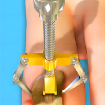 �޽Ŵ�ʦģ��