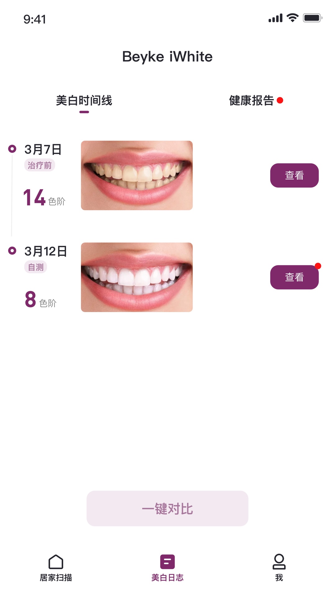 Beyke iWhitev2.0.7 ��׿��