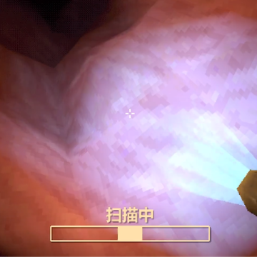 大肠的复仇(Revenge Of The Colon) 大肠的复仇(Revenge Of The Colon)