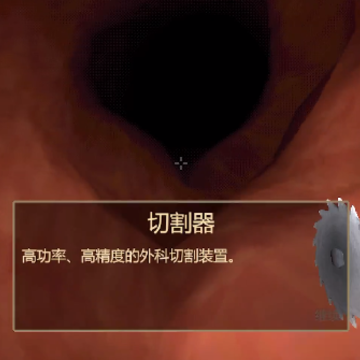 大肠的复仇(Revenge Of The Colon) 大肠的复仇(Revenge Of The Colon)