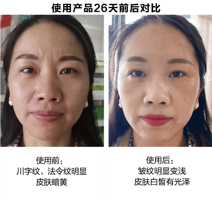 ZIIP Beauty������������ʹ��Ч���ԱȺ�����չʾ