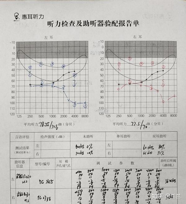冠听助听器声音清晰度实测对比图