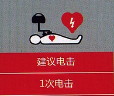 Primedic除颤仪连接教程